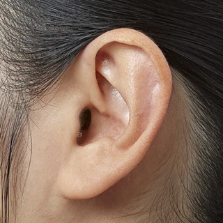 AUDÍFONO PHILIPS HEARLINK HL 50 IIC y CIC - Imagen 1