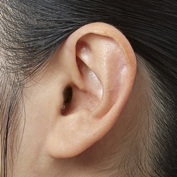 AUDÍFONO PHILIPS HEARLINK HL 50 IIC y CIC - Imagen 1